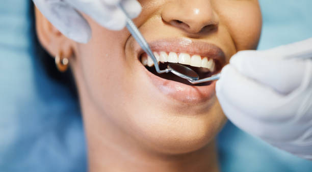 Best Root Canal Emergency Dentist  in Pittsfield, IL