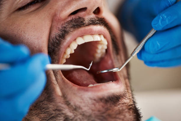 Best Broken Tooth Emergency  in Pittsfield, IL
