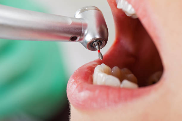 Best Dentist for Tooth Abscess  in Pittsfield, IL